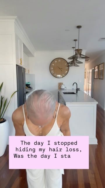 If they stare … Let them
If they wonder if you are wearing hair… Let them  Do what makes you happy and you love your own life.. #letthem #menopausehairloss #hairloss #alopecia